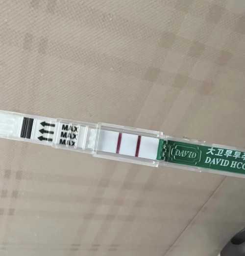 试管婴儿遇上疤痕妊娠怎么办？预防疤痕妊娠的6个方法