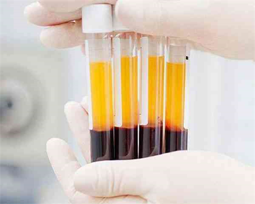 孕妇感冒如何治疗孕妇感冒治疗方法推荐,三代供卵试管