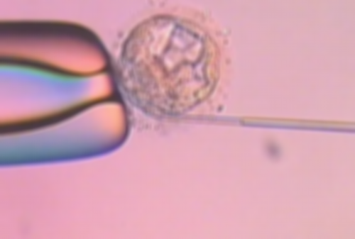 卵巢早衰想做试管婴儿有哪些步骤？,代生供卵代怀