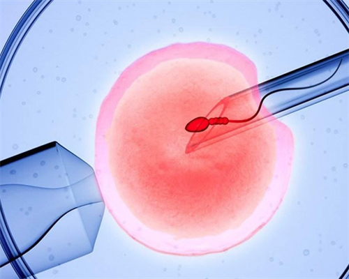 怀孕9周时胎停4天，是该等待自然流产还是直接人工流产？,正规试管供卵