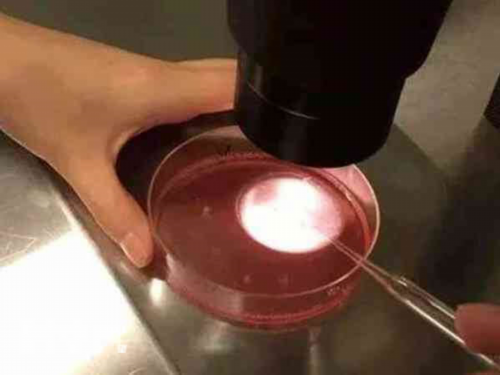 安徽助孕价钱多少钱,安徽做试管婴儿-安徽试管助孕怀男宝