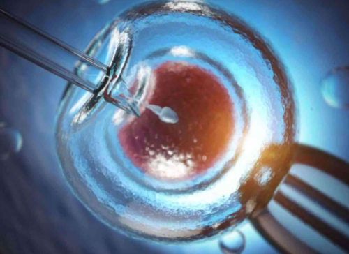 取卵后盆腔积液正常值取卵后盆腔积液范围,大龄代怀生子