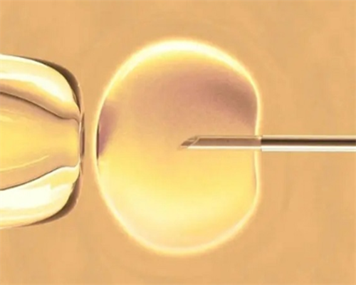 如何治疗死精症？四个方面的分析给出答案。,供卵代怀