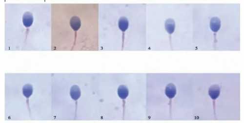 杭州助孕包性别中介|阳江三代试管婴儿-2026阳江3代试管医院及成功率科普