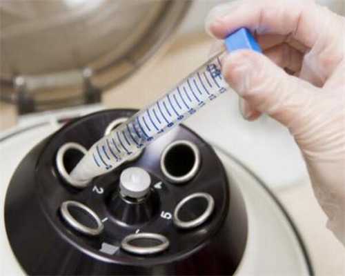 什么是安徽方法试管微刺激？?,安徽第三方辅助生殖合法吗？