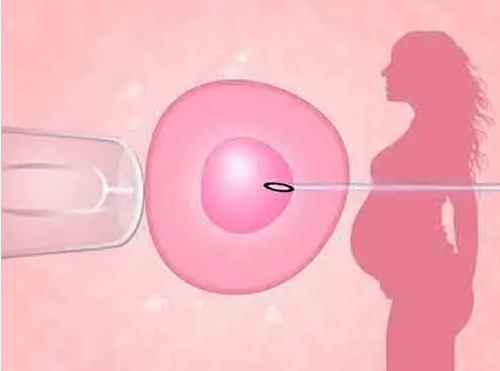 什么是试管婴儿降调?做试管婴儿长方案什么时候打降调,助孕服务